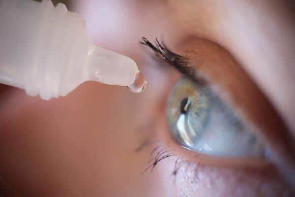 Uma paciente com olhos claros instila colírio nos olhos para eliminar sintoma de olho seco pós-cirurgia.
