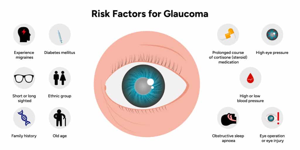 Quadro que aponta os fatores de risco para o desenvolvimento do glaucoma.