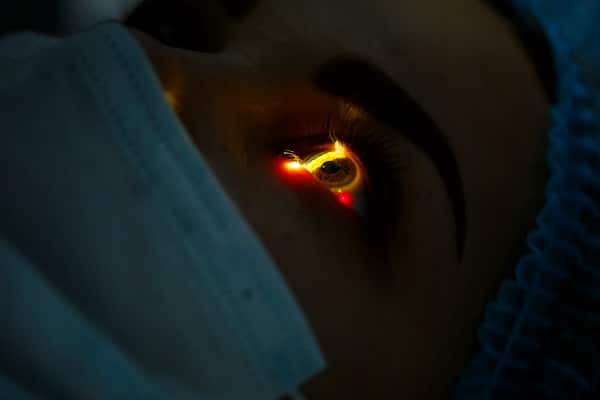 Olho de jovem que está sendo tratado com o uso do laser.